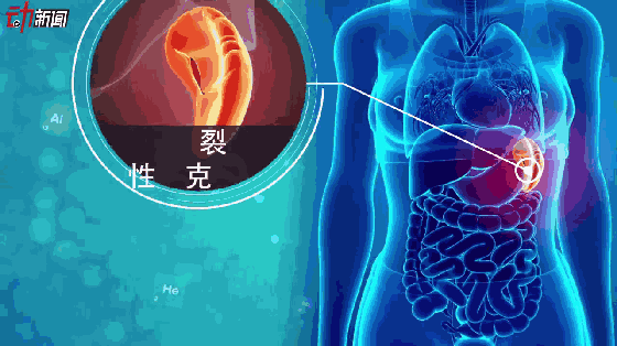 BBIN下载，BBIN国际厅，BBIN真人，BBIN赛事